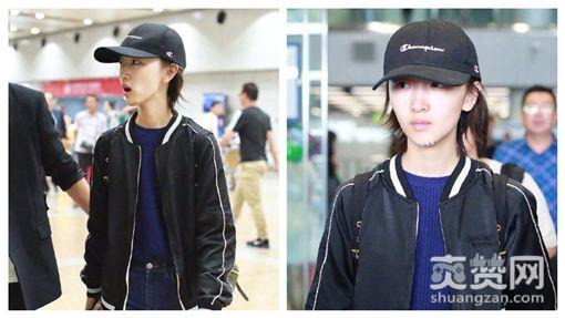 影后自杀？周冬雨下巴惊现3厘米疤痕事件始末