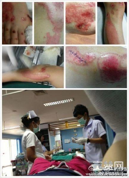 网红曝被薛之谦骗 李雨桐又曝新料称当年出车祸薛之谦隐瞒真相